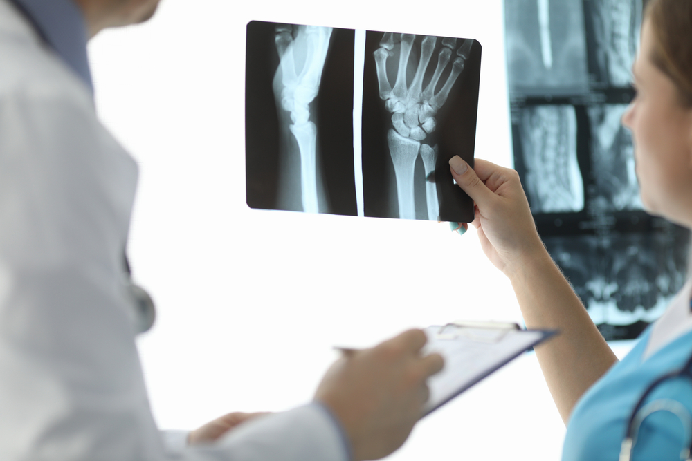 DRG therapy for CRPS in hand
