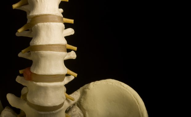 facet joint injection graphic