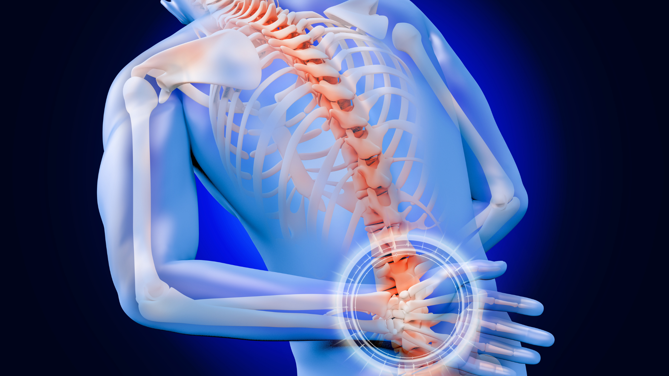 graphic spine failed back surgery syndrome