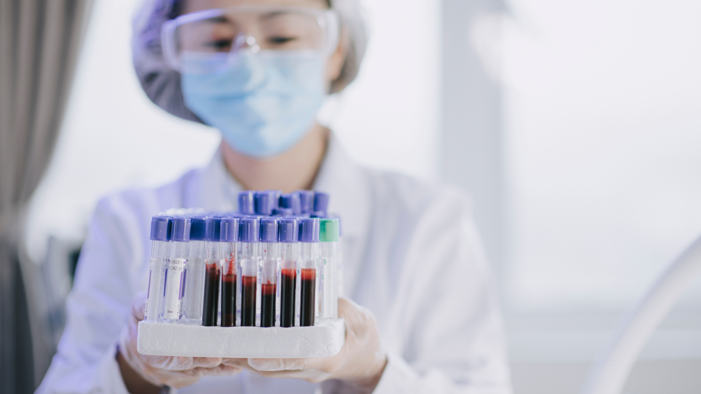 prp therapy tubes of blood in lab