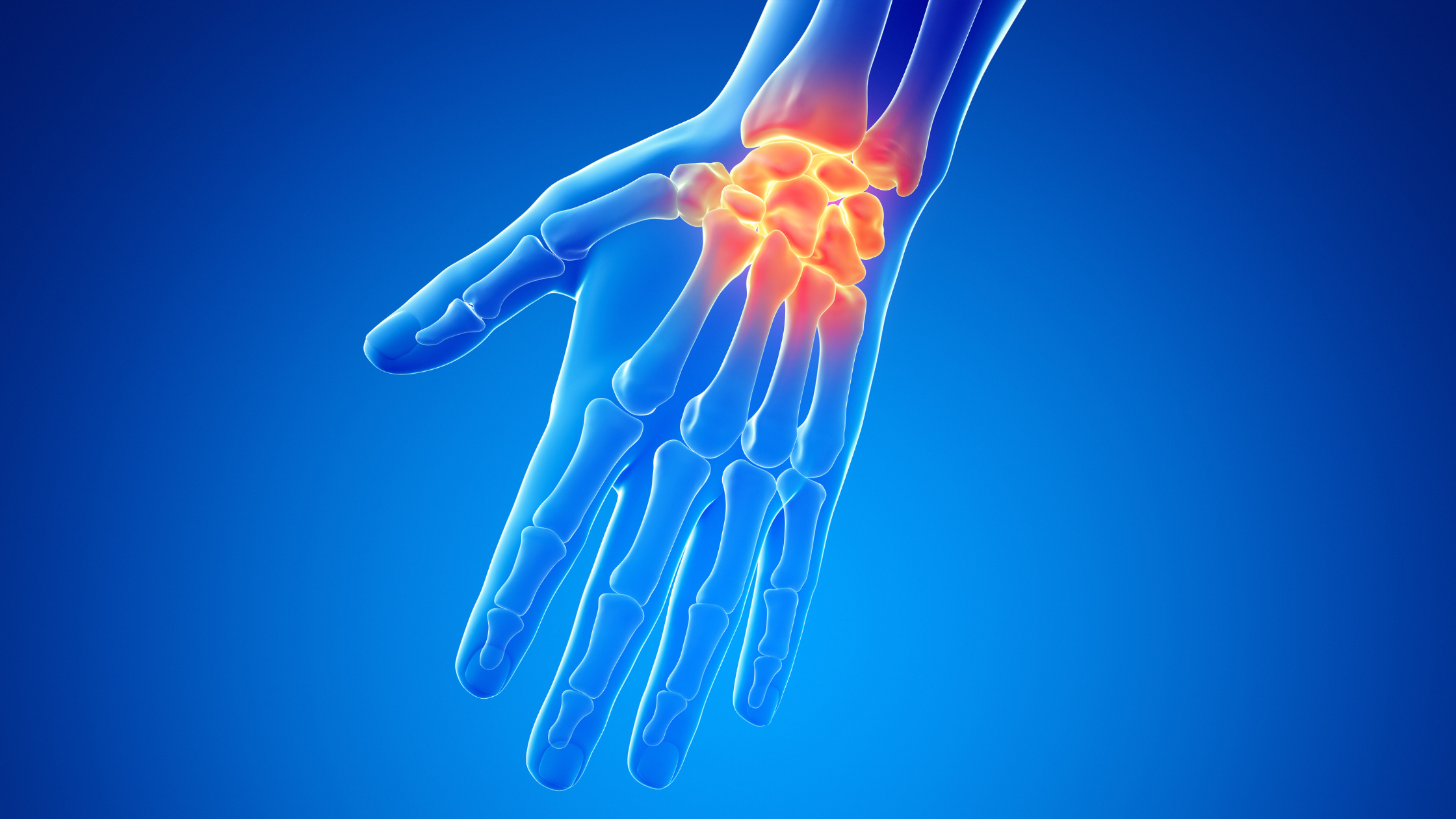 hand and wrist pain