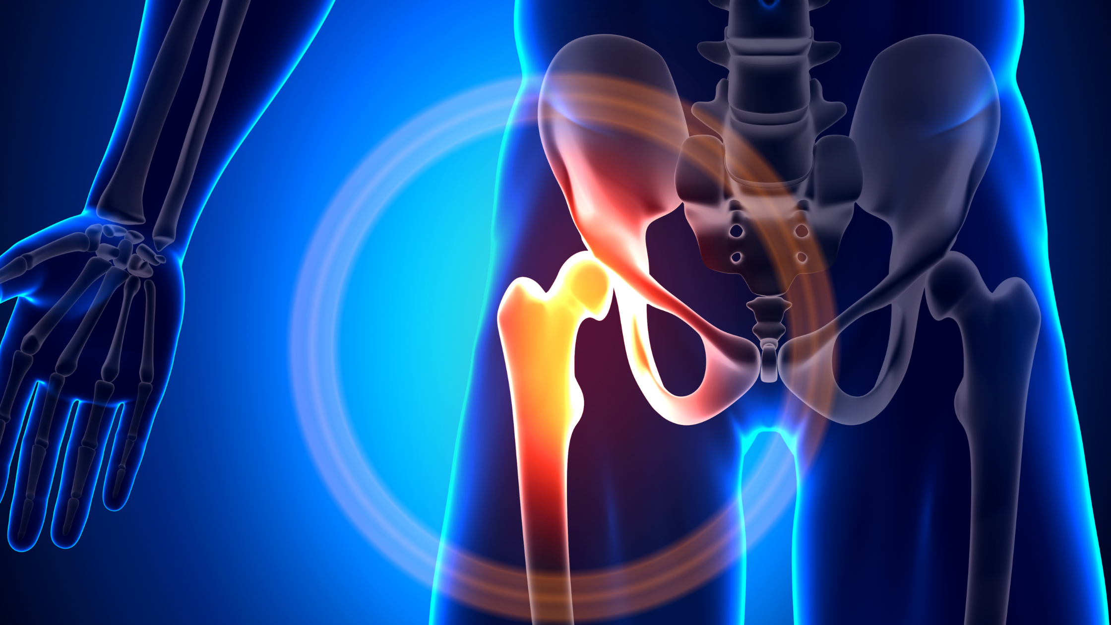 hip joint injections