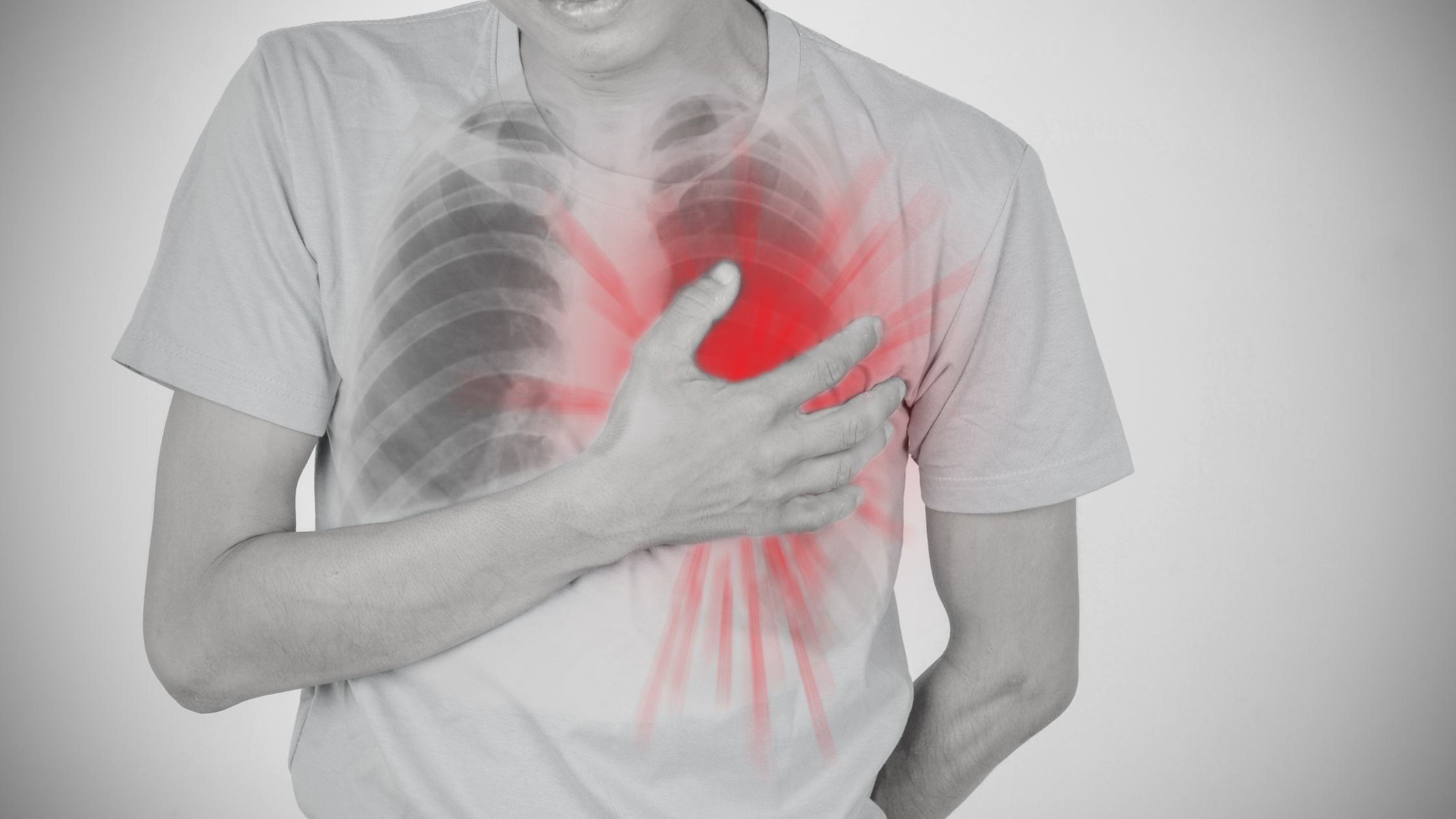 ESI for chest wall pain
