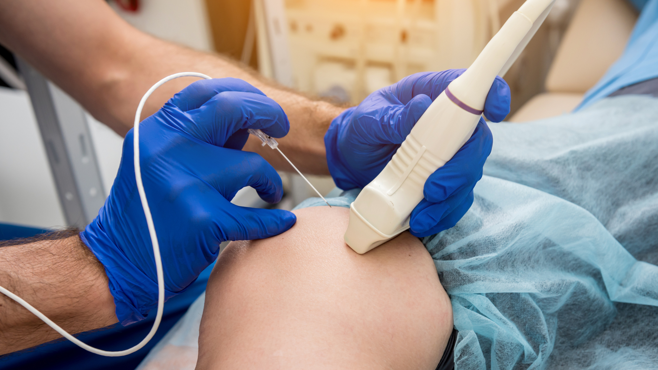 radiofrequency ablation for chronic pain