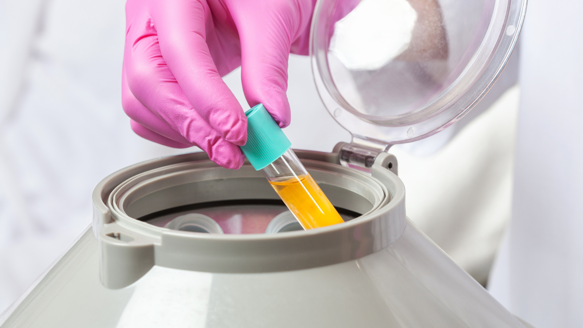PRP and cell therapy