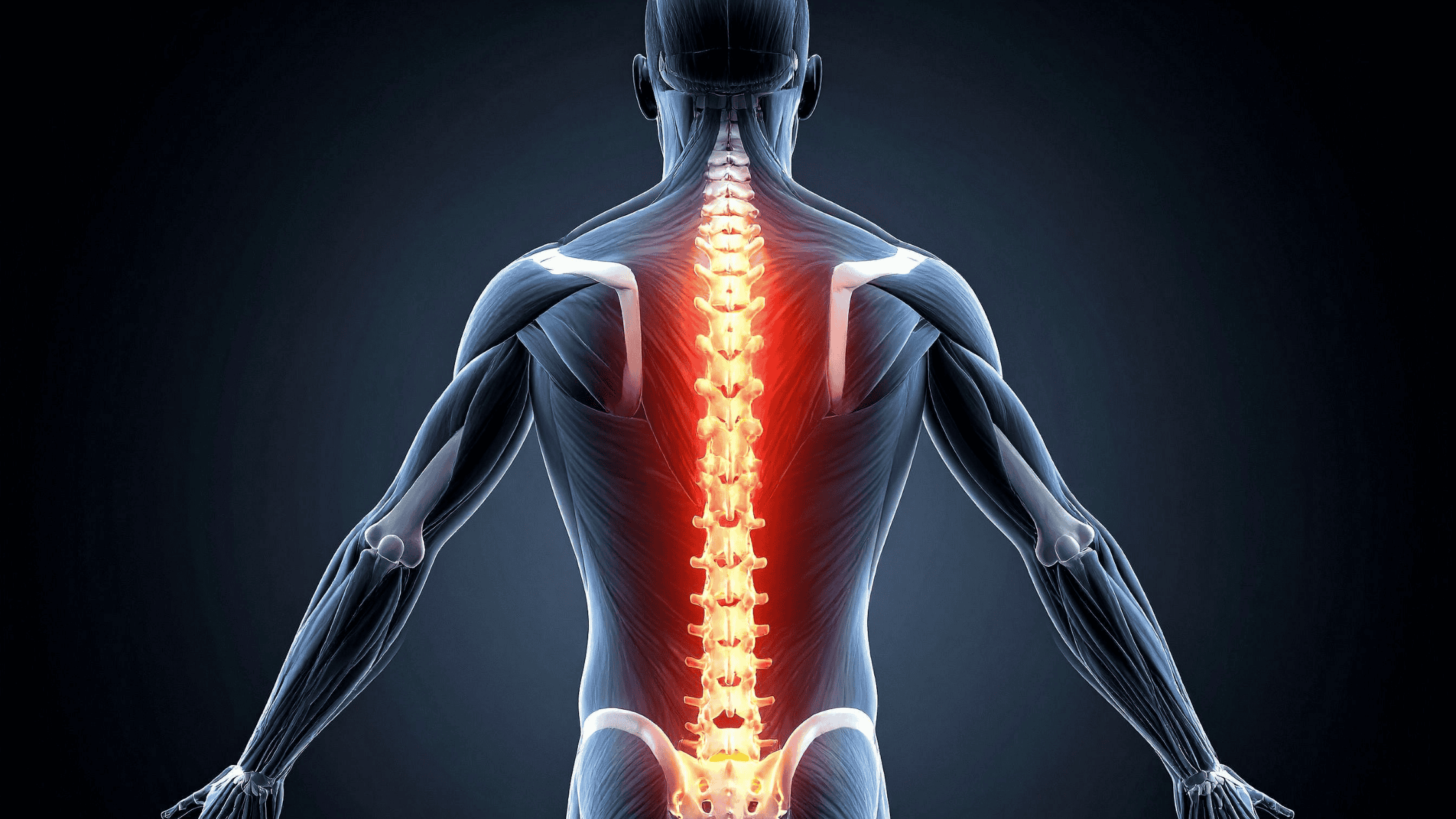 spinal cord stimulation