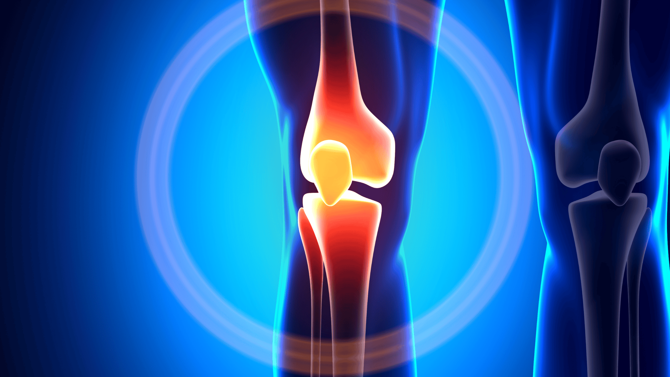 joint pain and arthritis